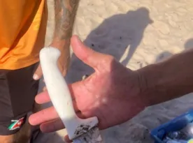 Imagem ilustrativa da imagem Ambulante é esfaqueada por colega de trabalho em praia