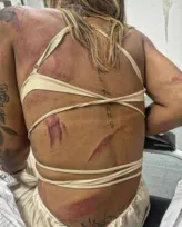 Imagem ilustrativa da imagem Assessora de vereadora de Niterói é brutalmente agredida