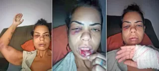 Imagem ilustrativa da imagem Vídeo: professora é espancada por casal em briga de trânsito no Rio