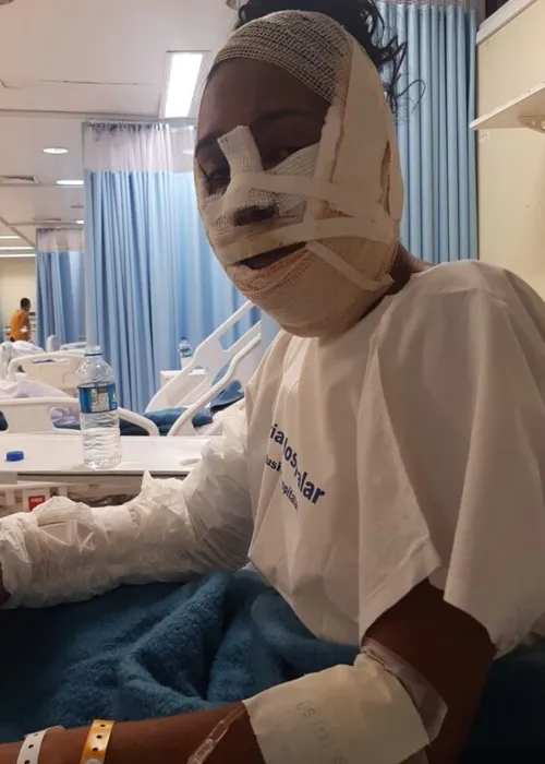 Jovem segue se recuperando, mas precisa de remédios e curativos