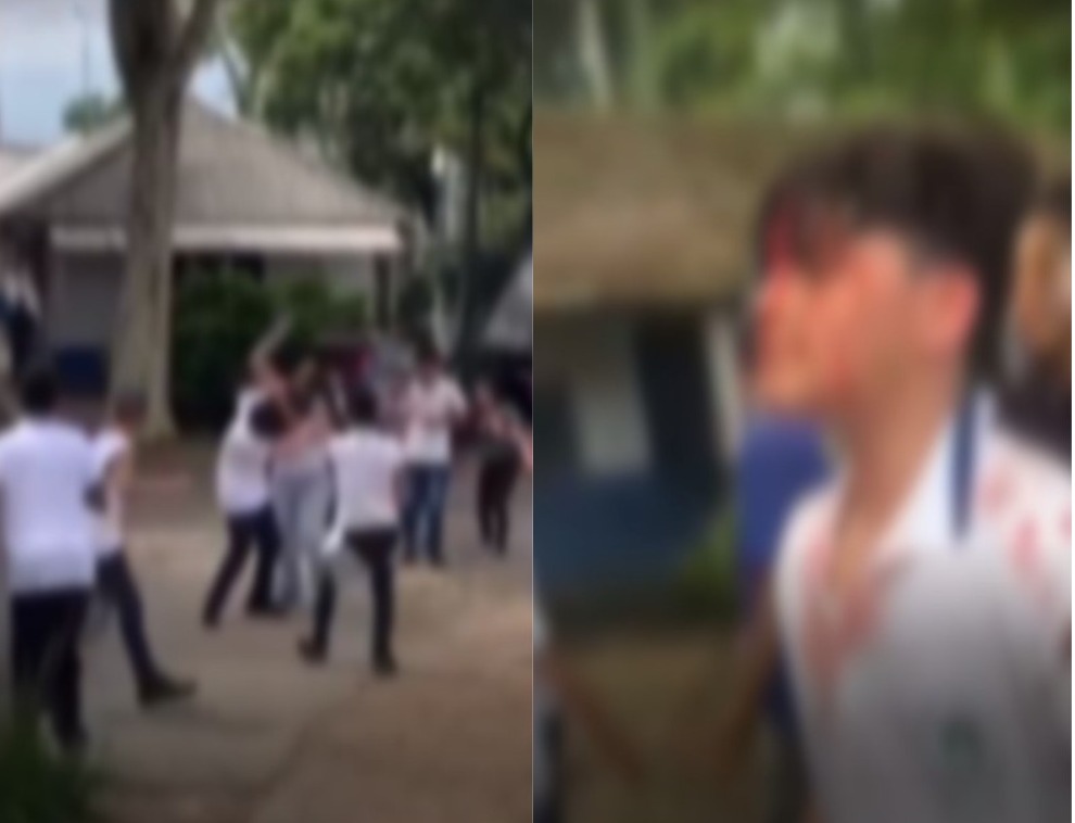 Aluno é Agredido A Pedradas Dentro De Escola No Rio Enfoco O Seu