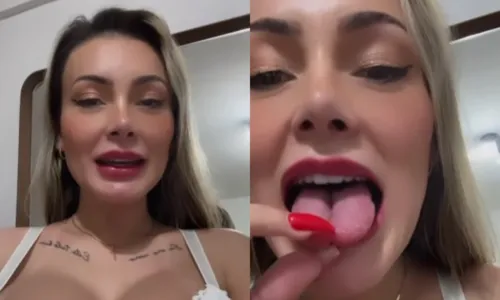 Urach revelou estar enfrentando problemas de dicção