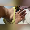A vítima foi agredida com golpe violento de faca