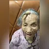 Imagem ilustrativa da imagem Idosa chinesa vive com 'chifre' na cabeça por conta de doença rara