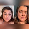 'Minha vontade de viver é maior que tudo', disse Preta antes da cirurgia