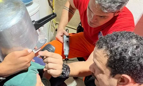 Após o susto, o garoto permaneceu consciente durante todo o procedimento