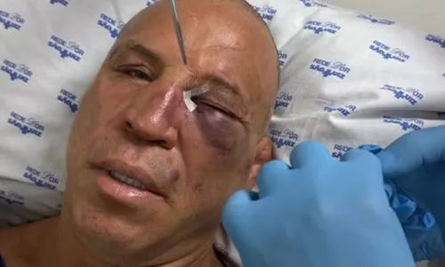 Wanderlei recebeu pontos na região do olho esquerdo