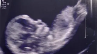 Imagem ilustrativa da imagem Jornalistas da Globo anunciam que terão um bebê