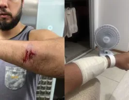 Imagem ilustrativa da imagem Engenheiro é atacado com pedaço de pau no meio da rua em Niterói