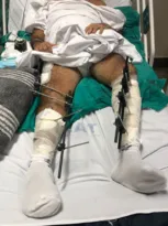 Imagem ilustrativa da imagem Filha de paciente reclama de demora para cirurgia em hospital de SG
