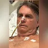Bolsonaro estava no hospital desde 13 de abril, quando passou por uma cirurgia de 12 horas