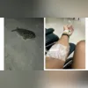 Imagem ilustrativa da imagem Fã de Lady Gaga pisa em baiacu após show e vai parar no hospital