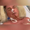 Bolsonaro está internado desde o dia 13 de abril