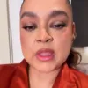 Cantora segue em tratamento contra um câncer no intestino