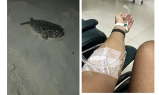 Imagem ilustrativa da imagem Fã de Lady Gaga pisa em baiacu após show e vai parar no hospital