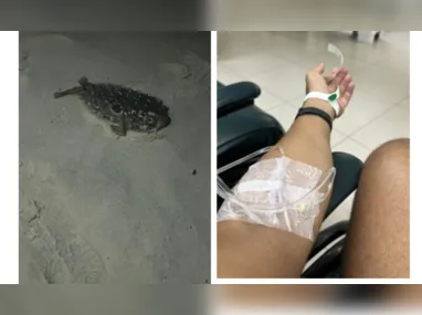Imagem ilustrativa da imagem Fã de Lady Gaga pisa em baiacu após show e vai parar no hospital