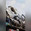 Menina passa por cirurgia no Hospital Estadual Alberto Torres (Heat), em São Gonçalo