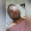 Acidente ocorreu no Ciep 401 - Lucimar de Souza Santos