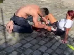 Mulher é atacada por pitbull dentro de condomínio na Região dos Lagos