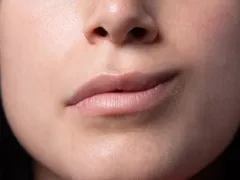 Paralisia facial: saiba causas, sintomas e tratamento