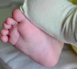 Casal acusado de agredir bebê recém-nascido é preso em Magé