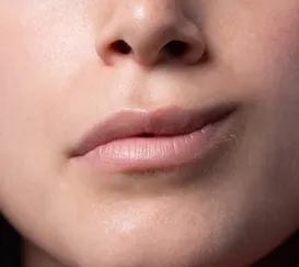 Paralisia facial: saiba causas, sintomas e tratamento