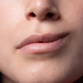 Paralisia facial: saiba causas, sintomas e tratamento