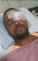 Imagem ilustrativa da imagem Taxista fica cego após tampa de bueiro explodir no Rio; vídeo
