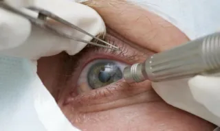 Imagem ilustrativa da imagem Médicos alertam para suplementos que alegam curar doenças nos olhos