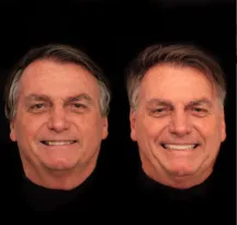 Imagem ilustrativa da imagem Novo visual: Bolsonaro faz harmonização facial em Goiânia