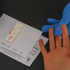 Dezembro vermelho: Brasil quer mais Prep no combate ao HIV