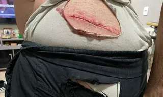 Imagem ilustrativa da imagem Banco de ônibus 'voa', rasga roupa e fere passageiro em SG; vídeo