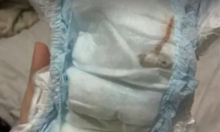 Imagem ilustrativa da imagem Rato é achado em fralda de bebê e choca mãe no Rio; vídeo