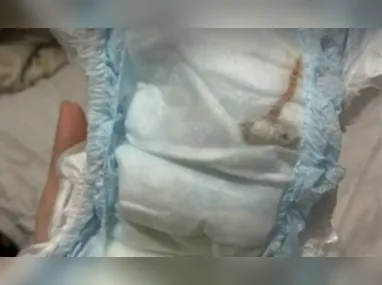 Imagem ilustrativa da imagem Rato é achado em fralda de bebê e choca mãe no Rio; vídeo