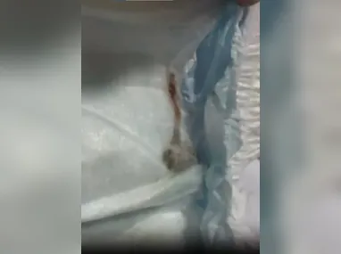 O adolescente ficou com marcas de agressão no corpo