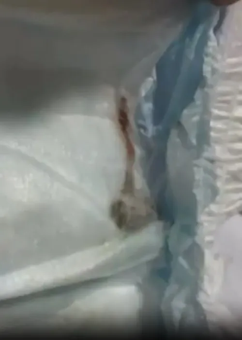 Mão se assustou com a mancha escura na fralda que estava em pacote lacrado