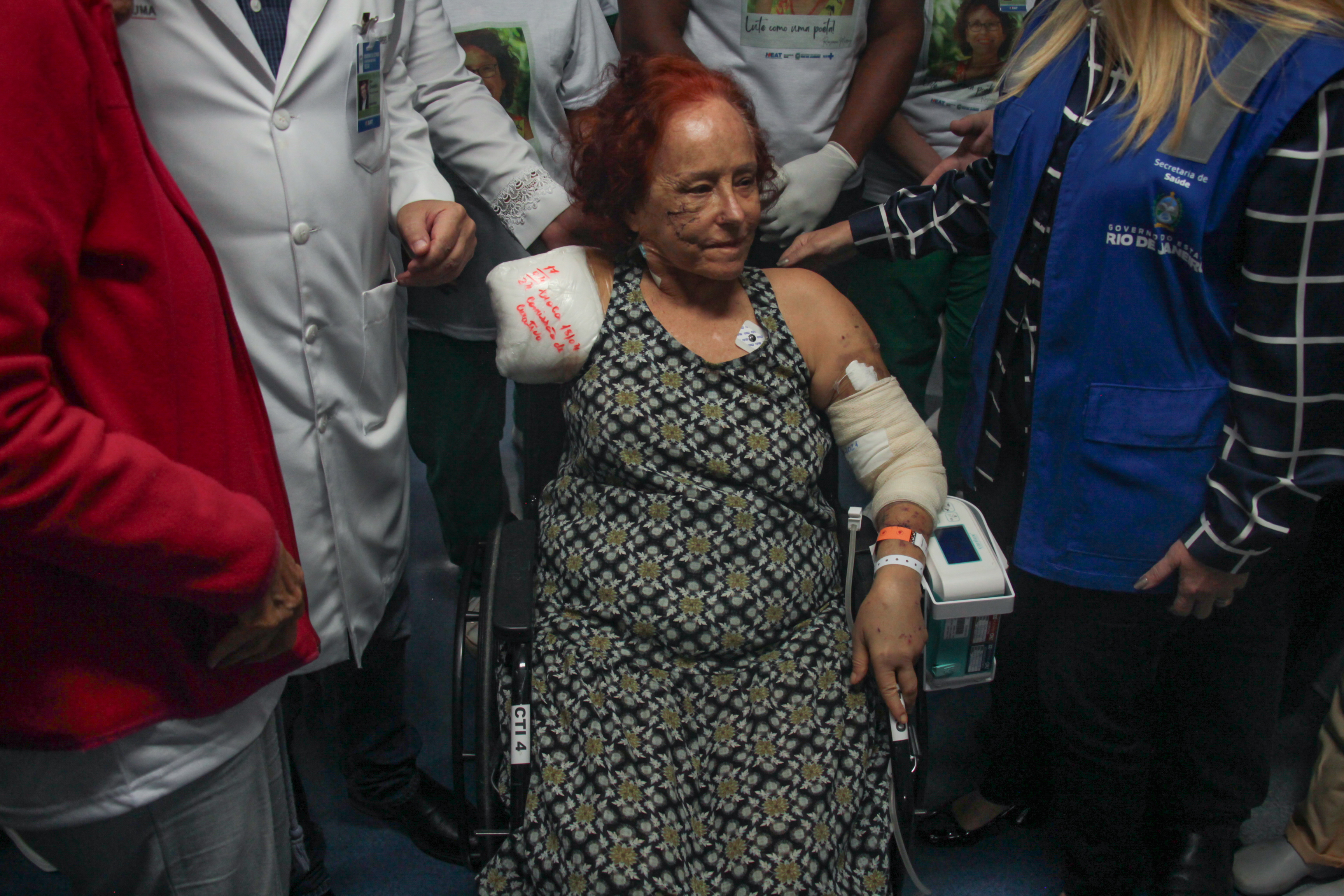 Roseane Murray teve o braço direito amputado e o esquerdo reconstruído