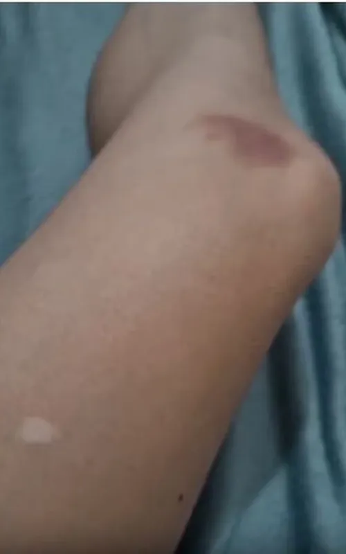 Mulher solicitou uma medida protetiva de urgência