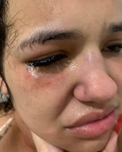 Influenciadora de Niterói denuncia pagodeiro por agressão