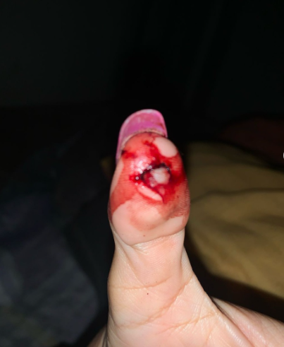 Influenciadora de Niterói denuncia pagodeiro por agressão