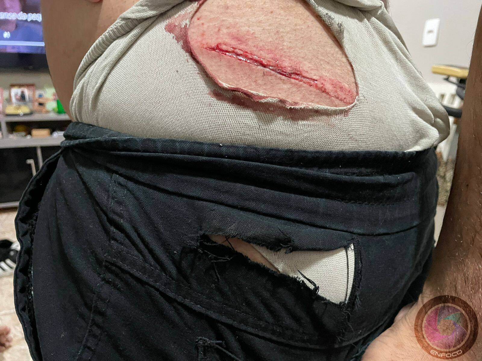 Ferimento provocado pela estrutura metálica do banco que se soltou