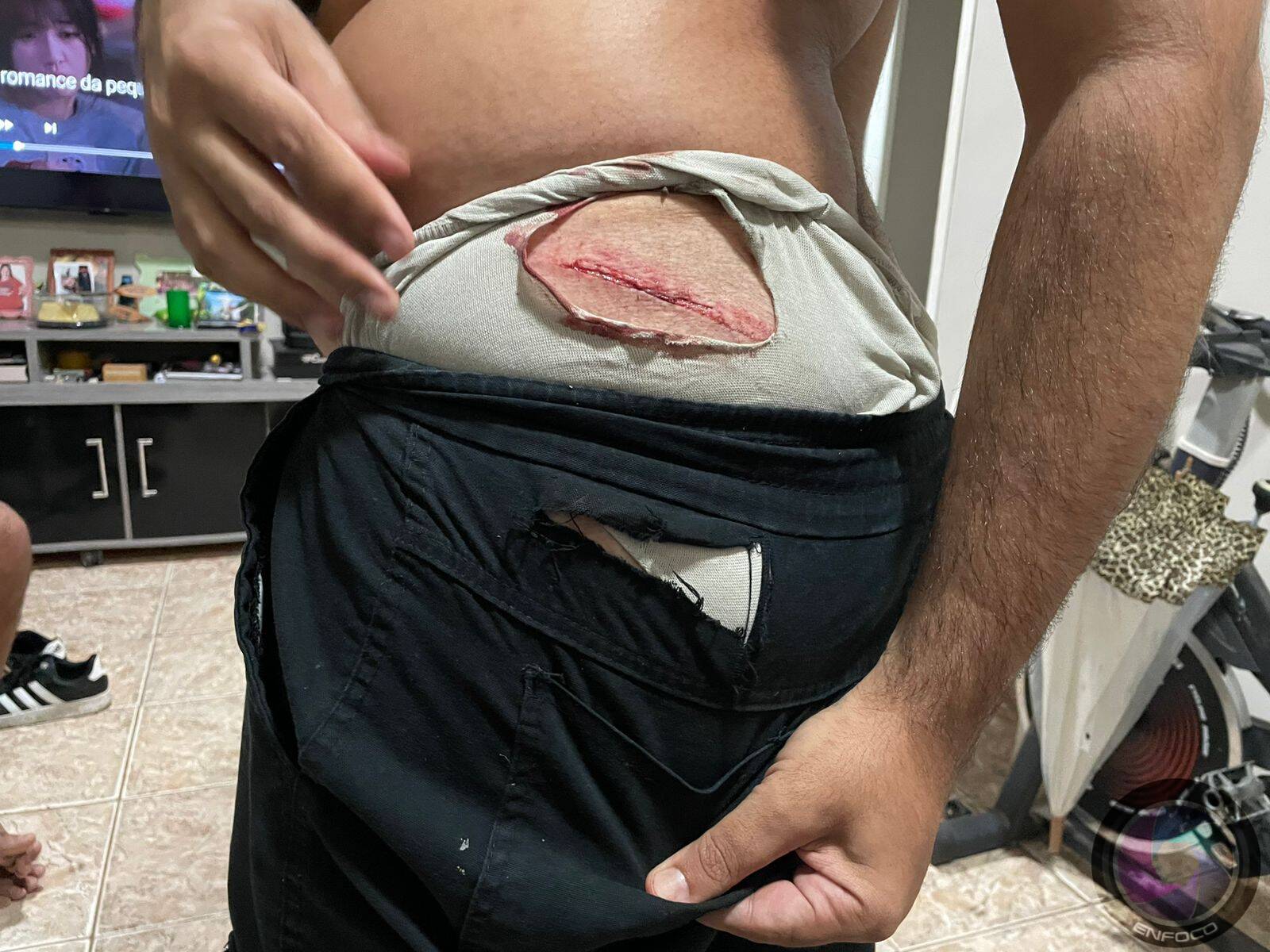 Ferimento provocado pela estrutura metálica do banco que se soltou