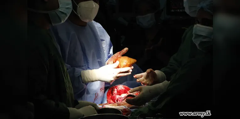 Médicos do exército do Sri Lanka realizaram a cirurgia
