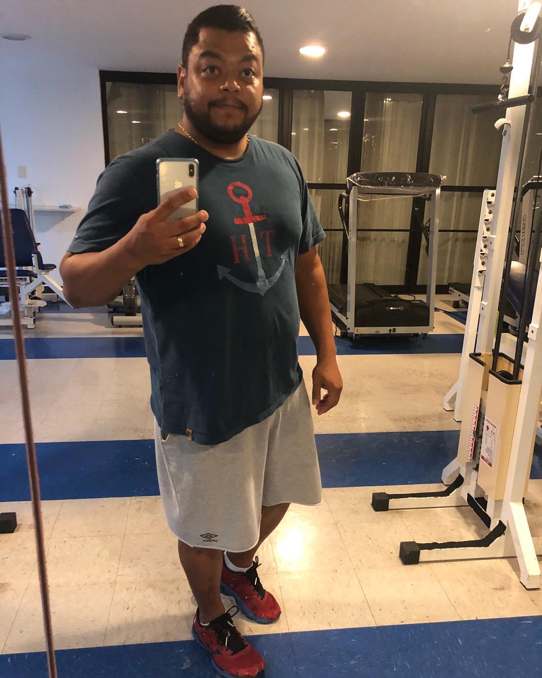 Antes do cantor realizar a cirurgia bariátrica