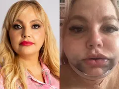 Dentista é denunciada por procedimento que deixou paciente em risco de morte no Rio