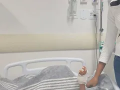 Médicos dão dicas para evitar queimaduras em festas juninas
