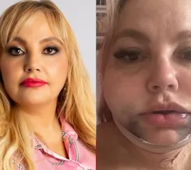 Dentista é denunciada por procedimento que deixou paciente em risco de morte no Rio