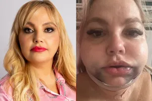 Imagem ilustrativa da imagem Dentista é denunciada por procedimento que deixou paciente em risco de morte no Rio