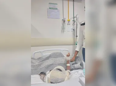 Imagem ilustrativa da imagem Médicos dão dicas para evitar queimaduras em festas juninas