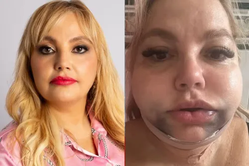 Vítima ficou internada por 12 dias em CTI